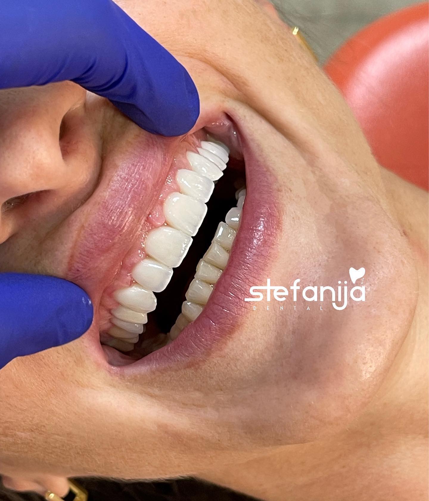 stefanijadental_1660770541_2907076463069759882_207070939 (1)