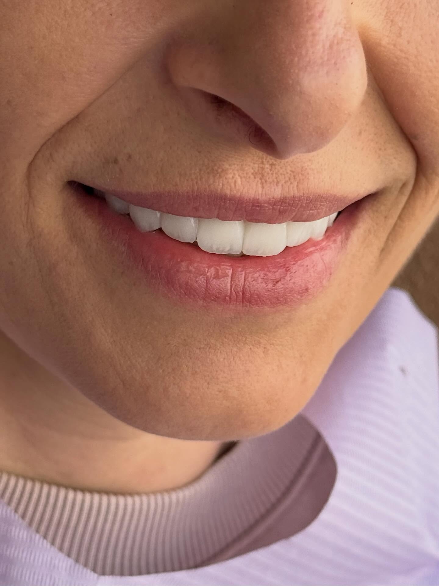 stefanijadental_1760083270_3740172017006821483_207070939