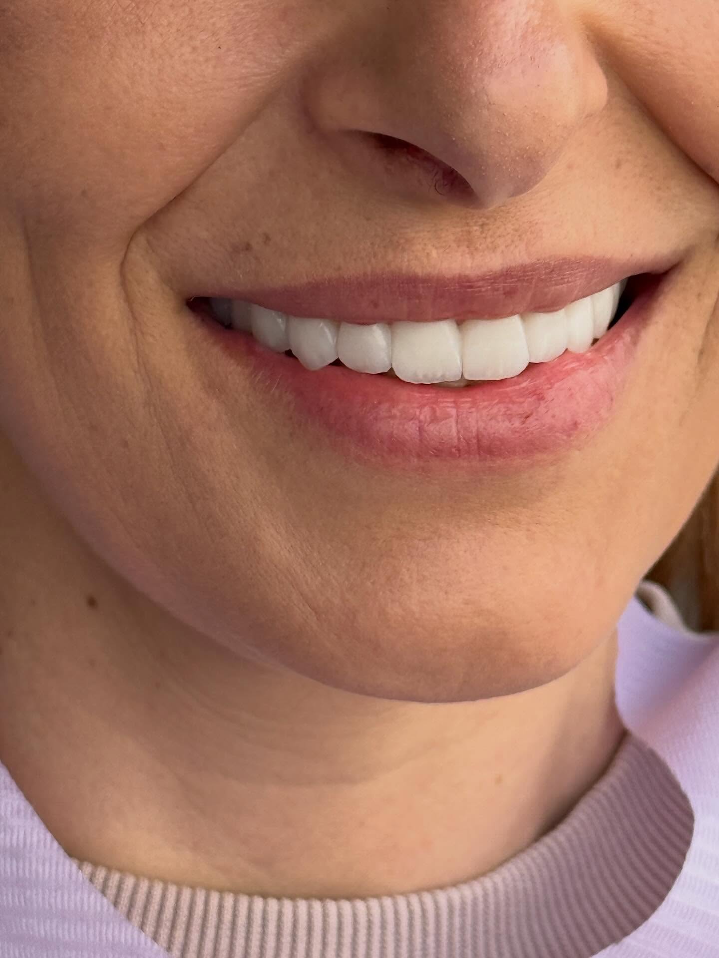 stefanijadental_1760083270_3740172017006838738_207070939