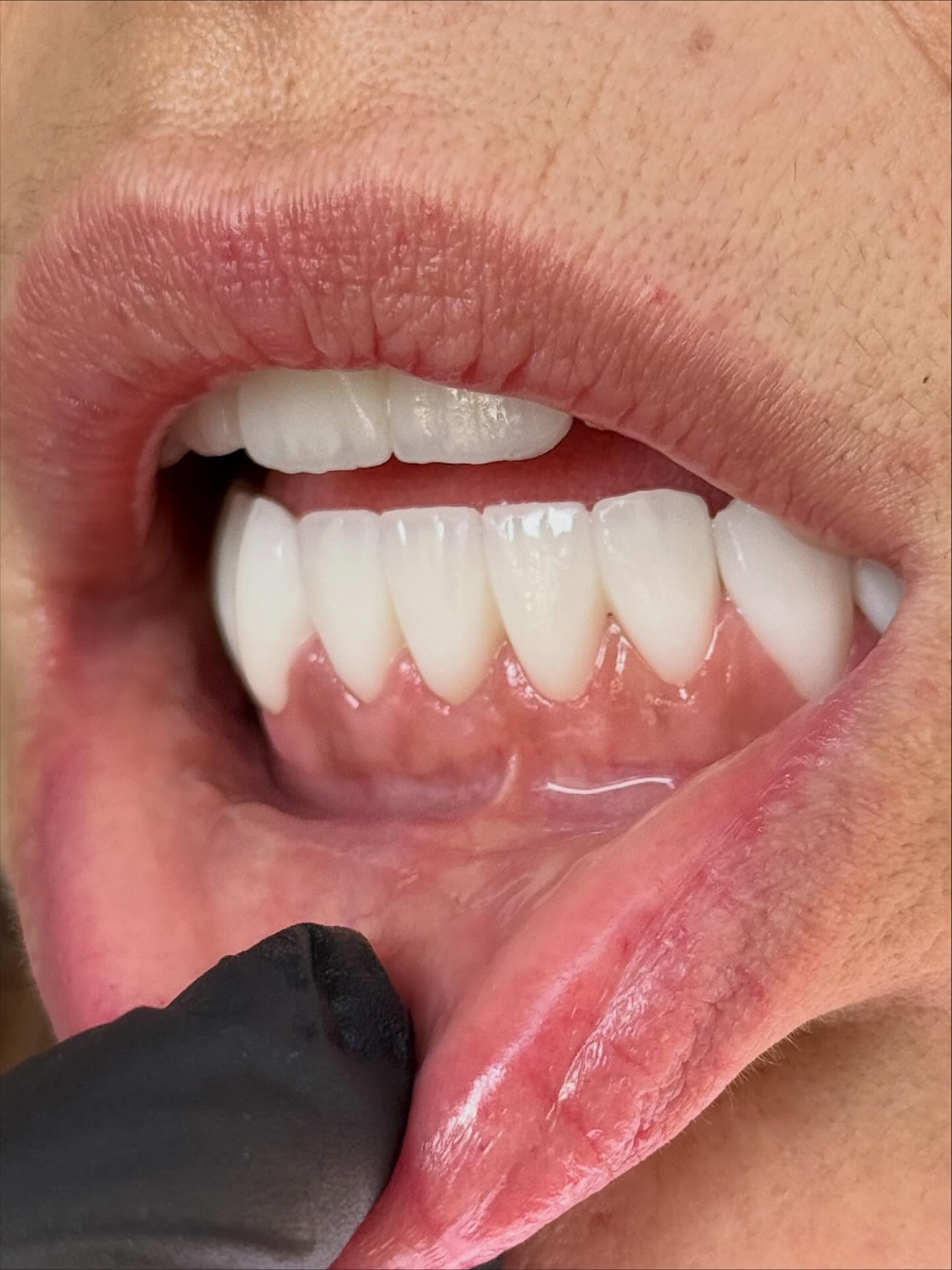 stefanijadental_1761045806_3748246350061109360_207070939