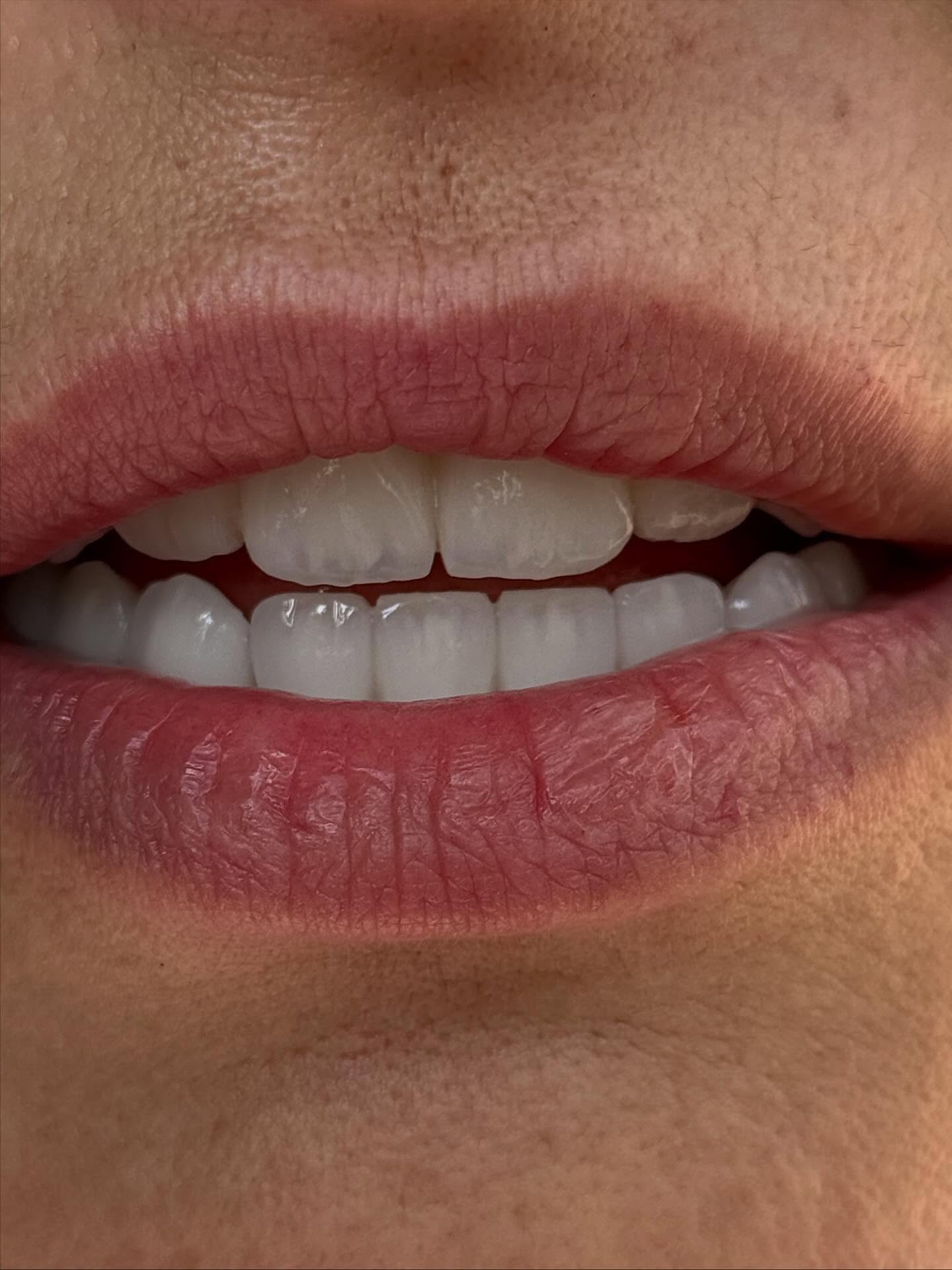 stefanijadental_1761045806_3748246350061130401_207070939